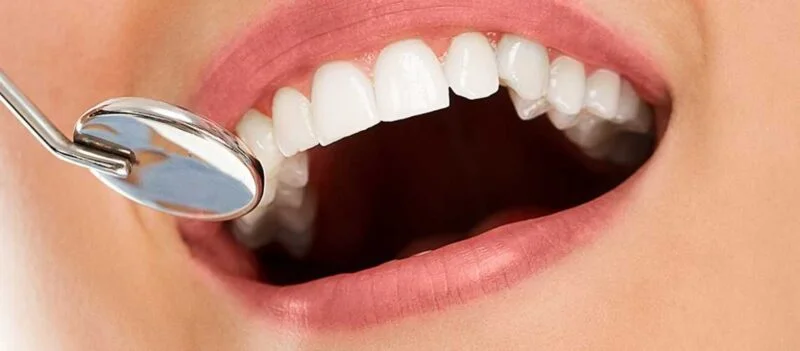 La Connexion Entre l’Alimentation et la Perte de Dents