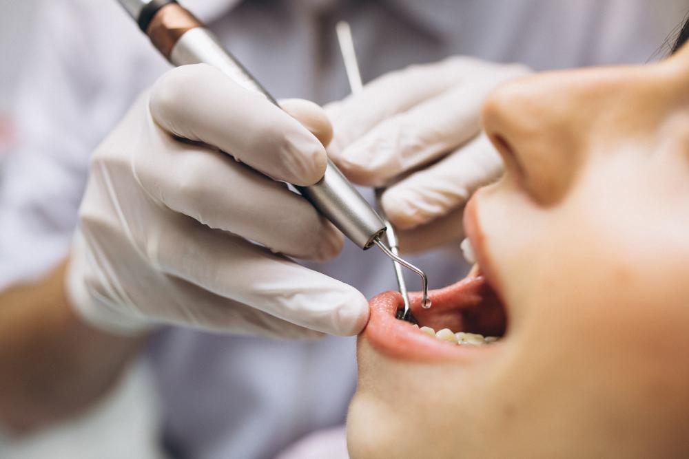 Économisez sur une assurance dentaire supplémentaire – avec des soins dentaires en Turquie
