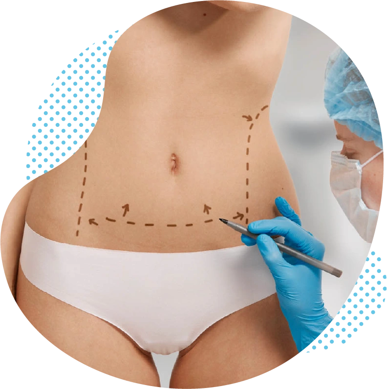 L’abdominoplastie en Turquie à Antalya réalisée par des chirurgiens plasticiens expérimentés en Turquie