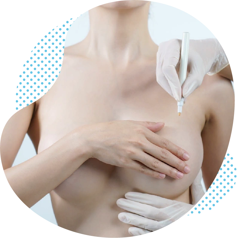À quoi faut-il faire attention avant une opération de lifting des seins en Turquie / Antalya ?