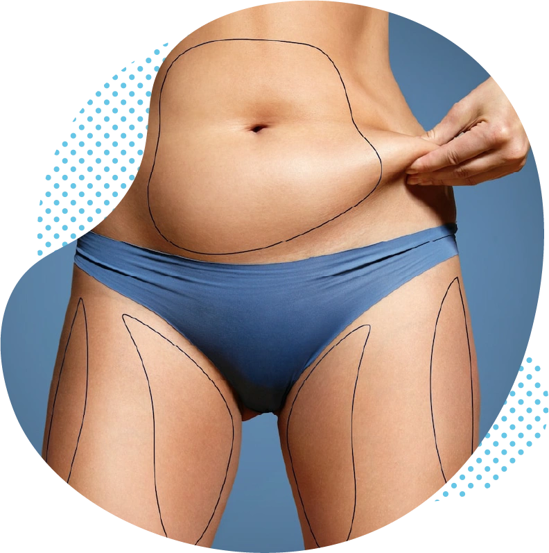 Comment vos chirurgiens esthétiques turcs procèdent-ils la liposuccion ?
