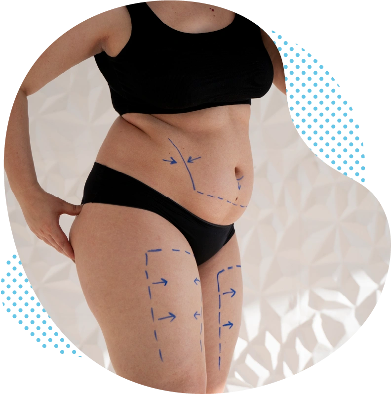 Liposuccion en Turquie à Antalya : Conseils complets et concept de traitement individualisé