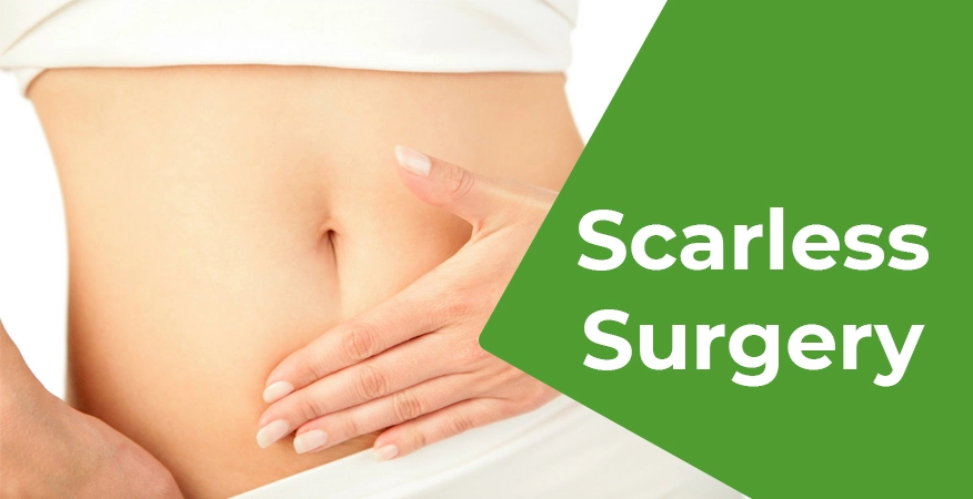 Gastric sleeve without scar in Turkey, Antalya – Overview​