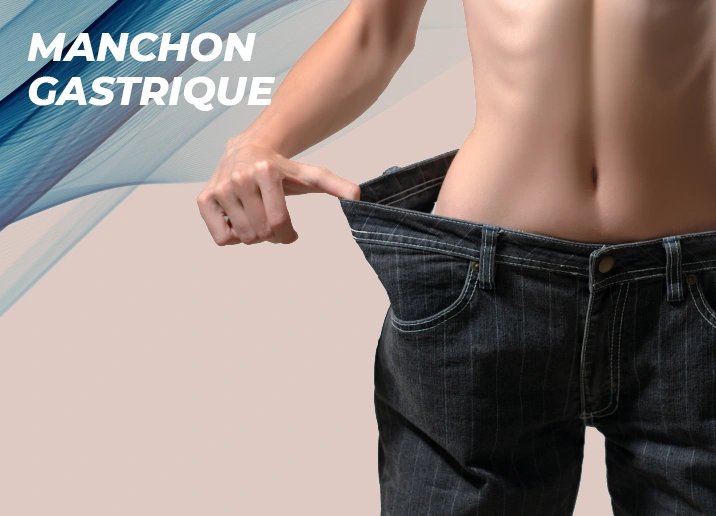 Manchon gastrique Turquie