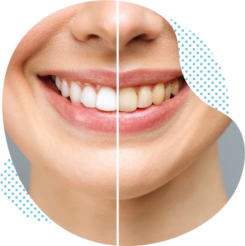 Orthodontia in turkey