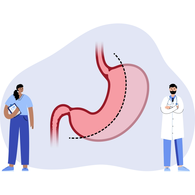 sleeve-gastrectomy surgery turkey