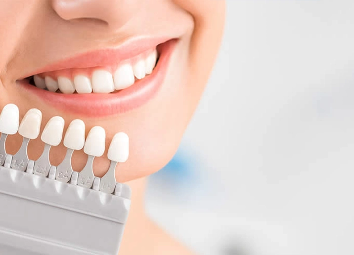 Soins Dentaires Prix 5 Zahnveneers türkei